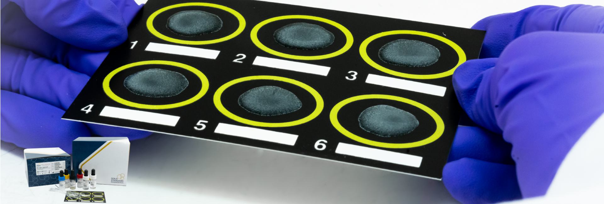 Microgen Latex Test Microgen Latex Test